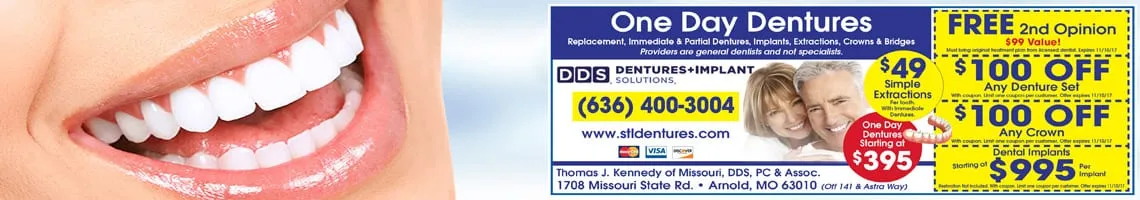 partial dentures in festus missouri